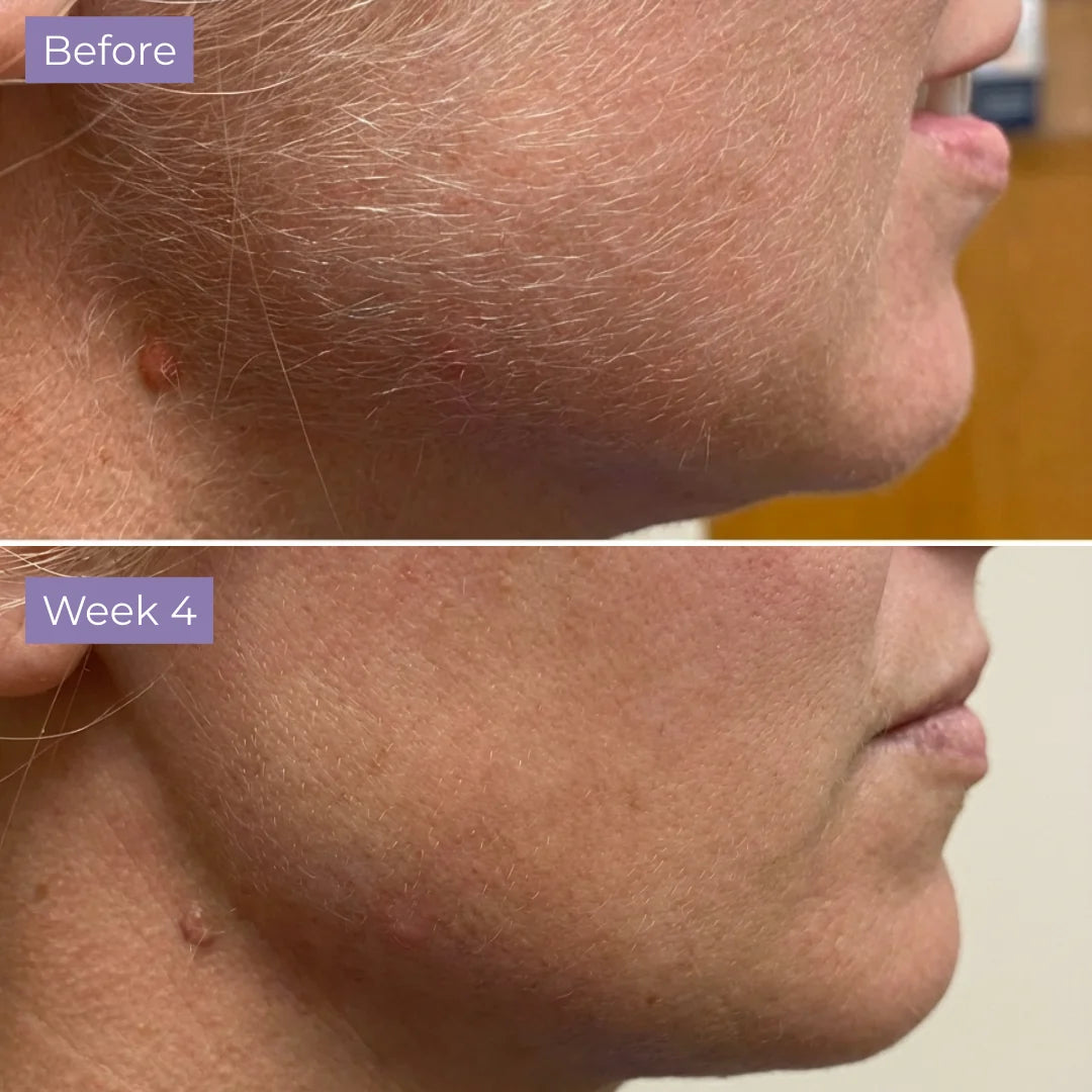 Evolène™ - Anti-Hair Growth Serum